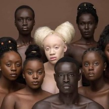 African women of many colors include an albino